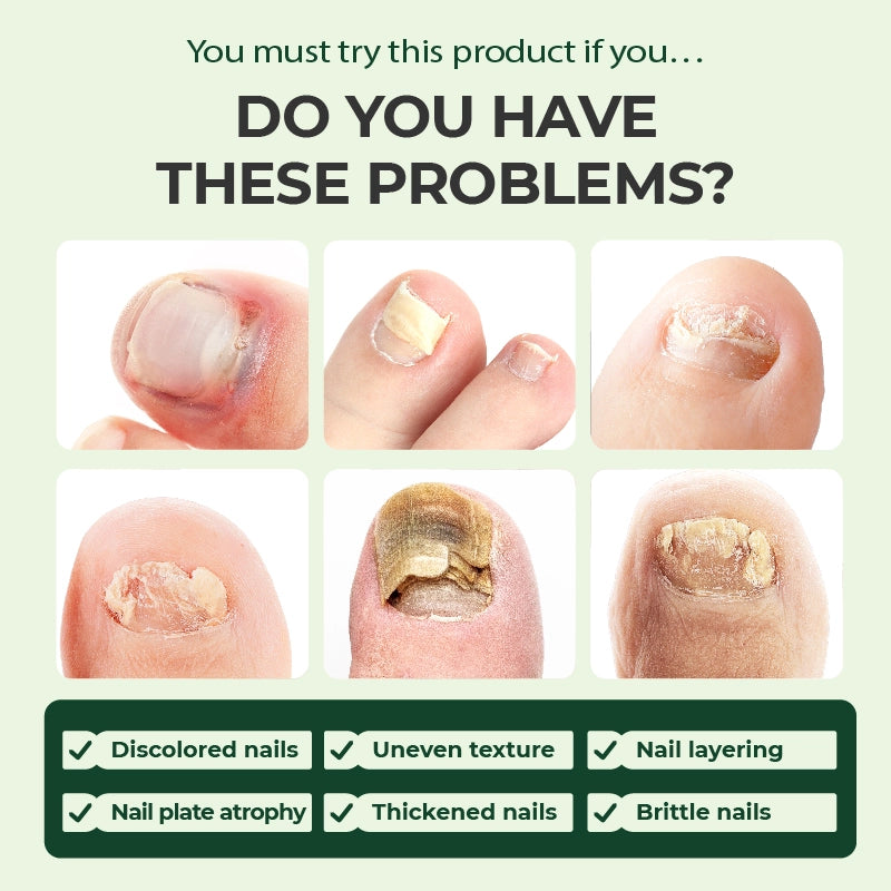 Serum do pielęgnacji paznokci Kreain