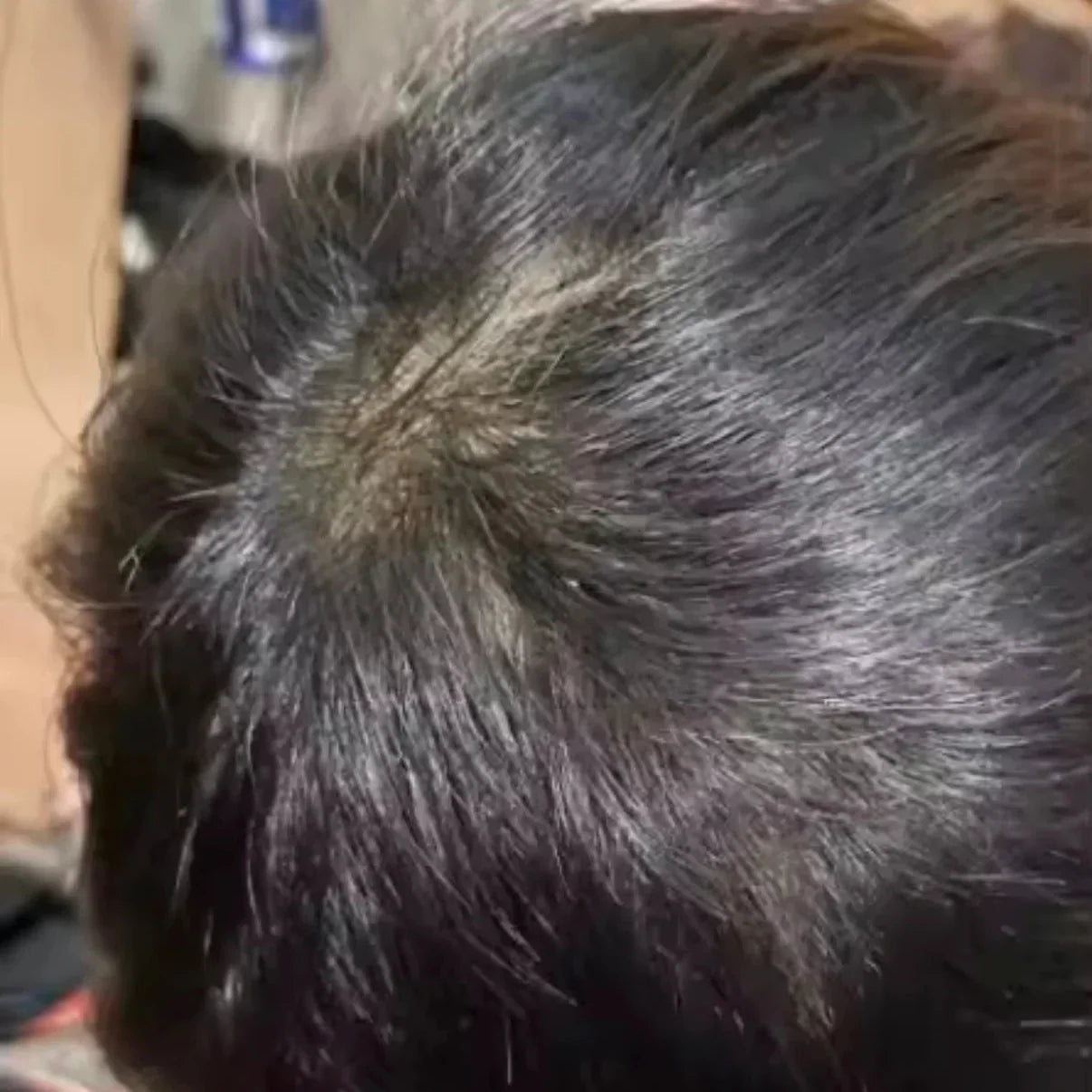 HairsKing™ – Κρέμα Μαλλιών για Άμεση Πυκνότητα