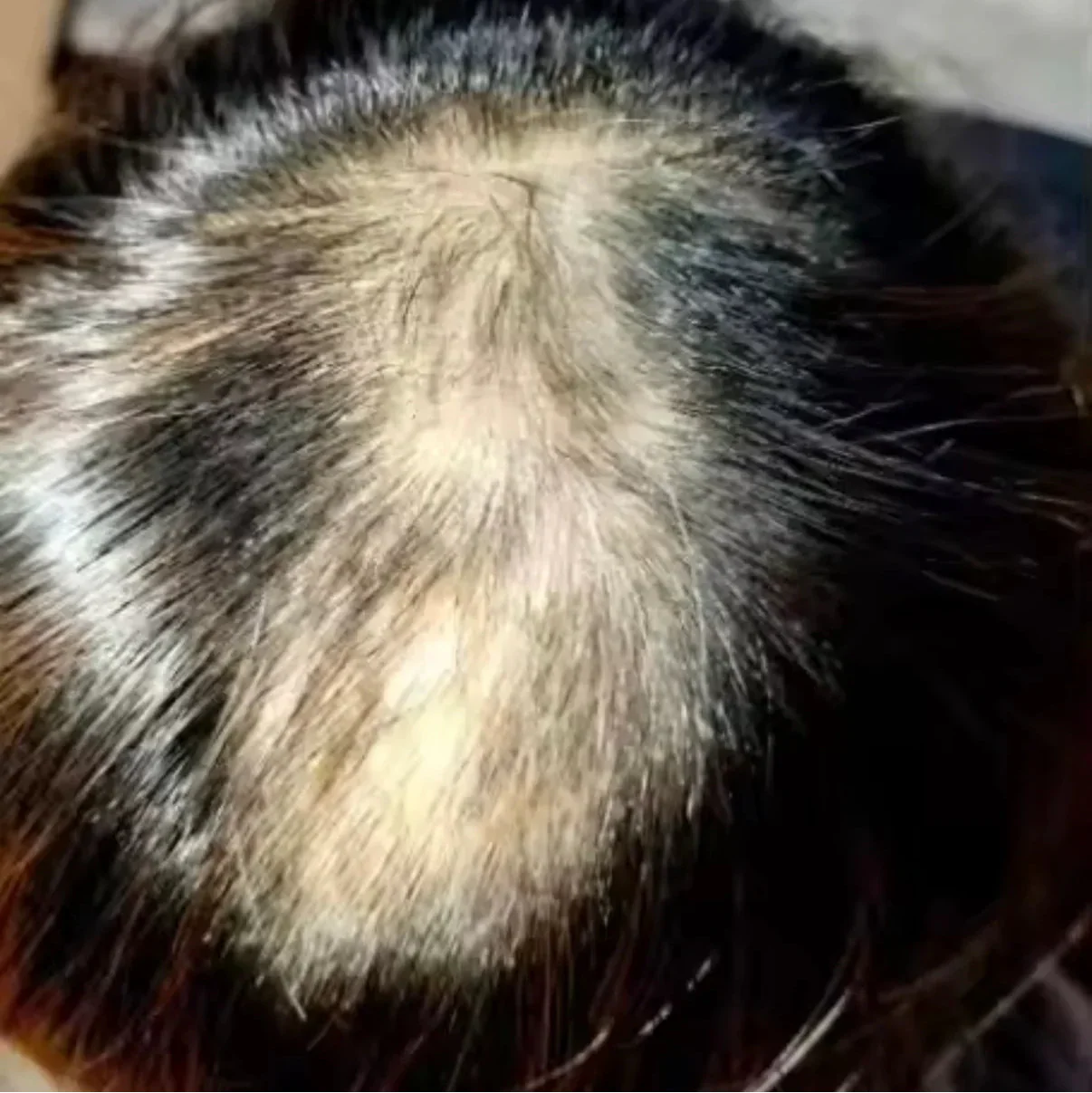 HairsActivator™ – Krem do Włosów o natychmiastowej Gęstości