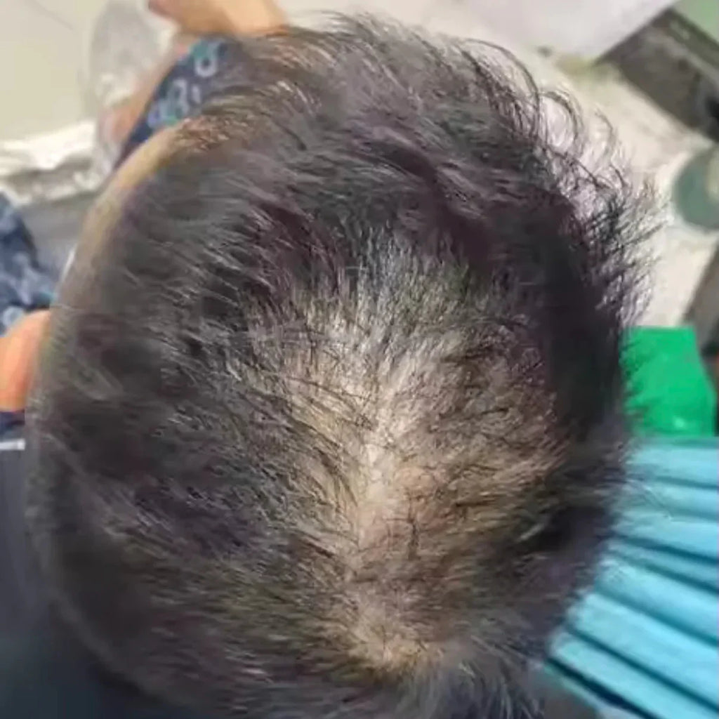 Hairs Spray anticaduta NOVALAB a infoltimento rapido - Edizione limitata