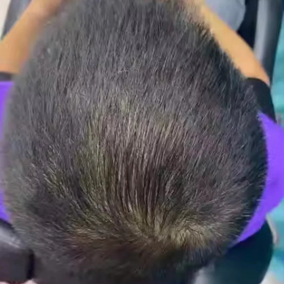 Hairs Spray anticaduta NOVALAB a infoltimento rapido - Edizione limitata