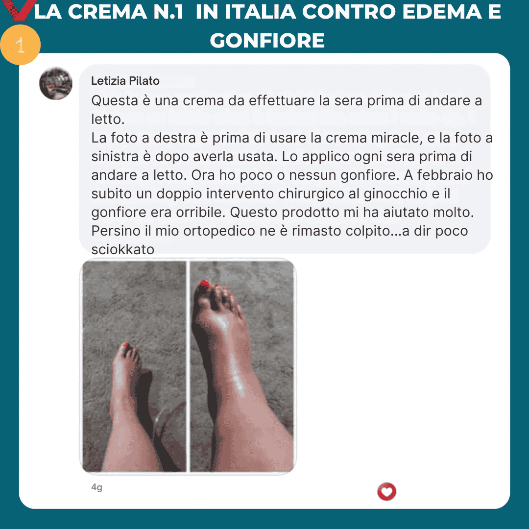 2 Creme VARICOLIFT MIRACLE - Il potere delle erbe naturali